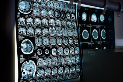 Ücretsiz kanser taramaları için SMS ile bilgilendirme dönemi