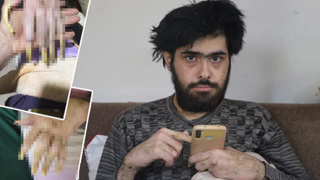 3 yıldır evden dışarı çıkmıyor! Depremden sonra bu hale geldi | Sadece telefonla oynuyor: Elimde olsa tuvalete de gitmem yemek de yemem